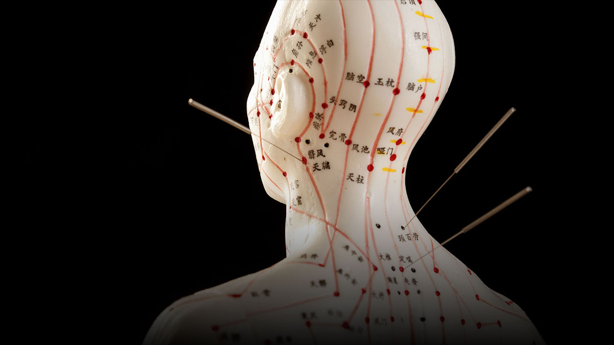 accupuncture meridian lines