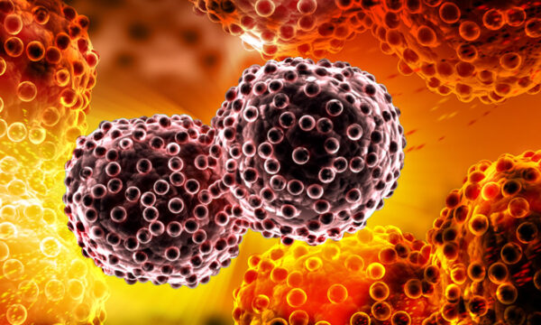 screening for cancer with a microscopic amount of gold