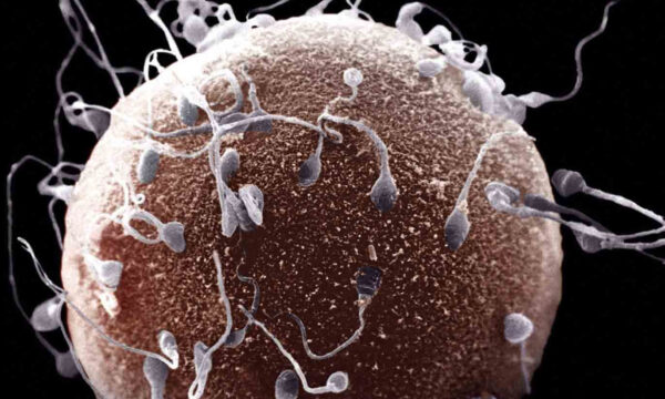 evolution’s fight for the y chromosome