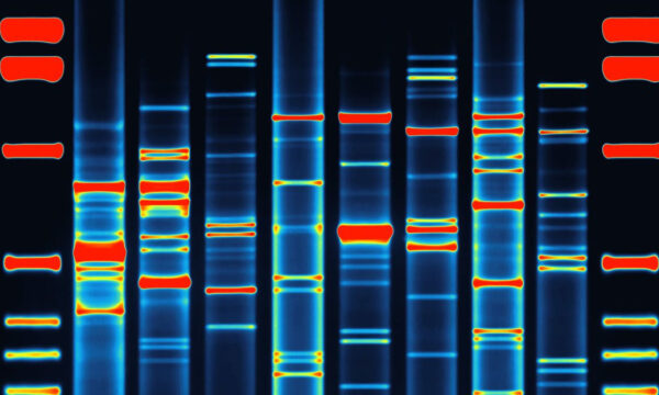 oh my, what lovely genes you have