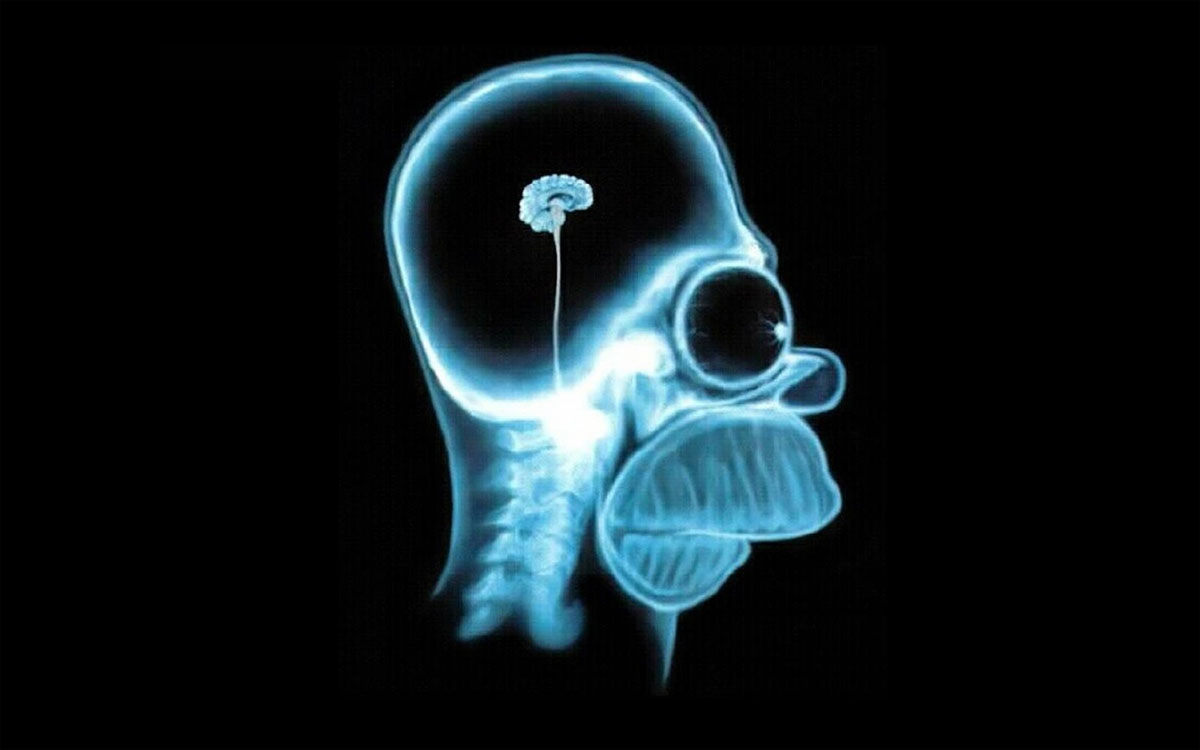 homer simpson brain scan